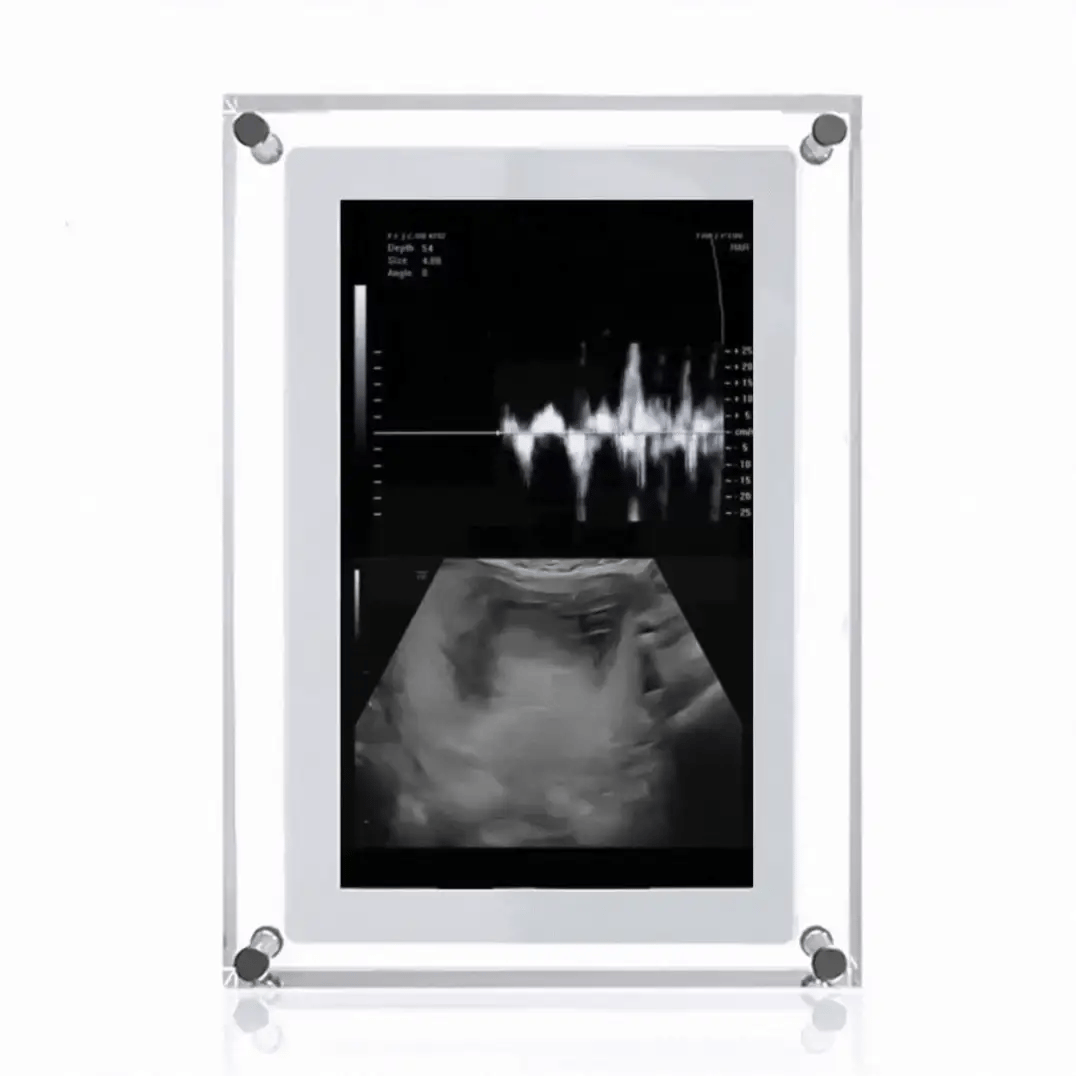 Marco Digital de Latido Eterno