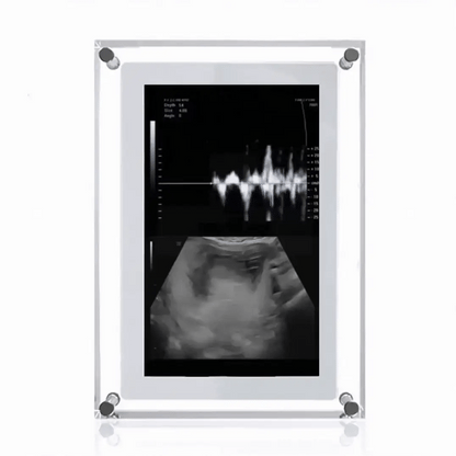 Marco Digital de Latido Eterno