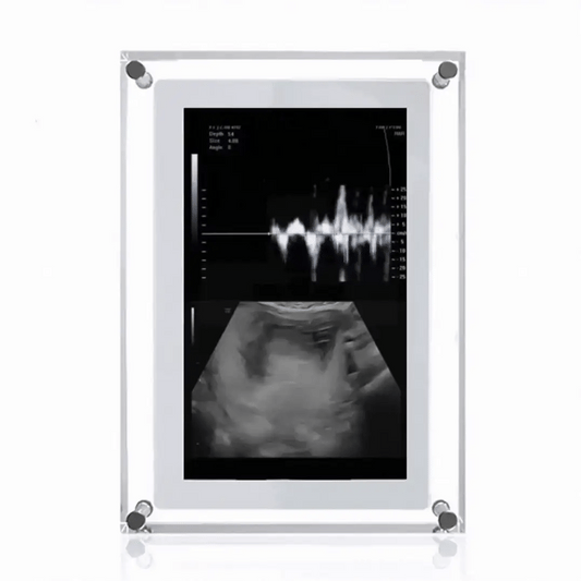 Marco Digital de Latido Eterno